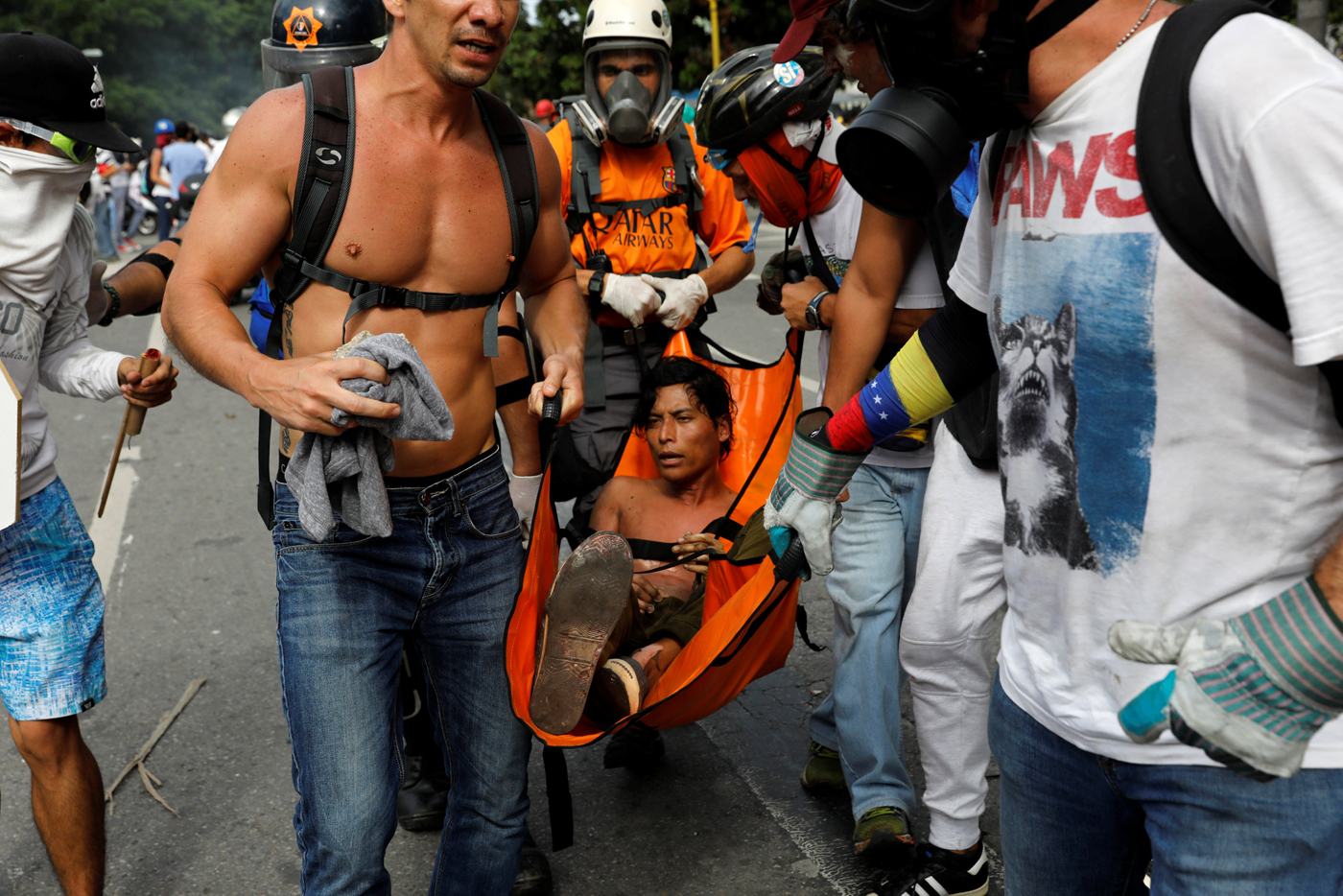 Reuters / joven quemado en las protestas de este #3May