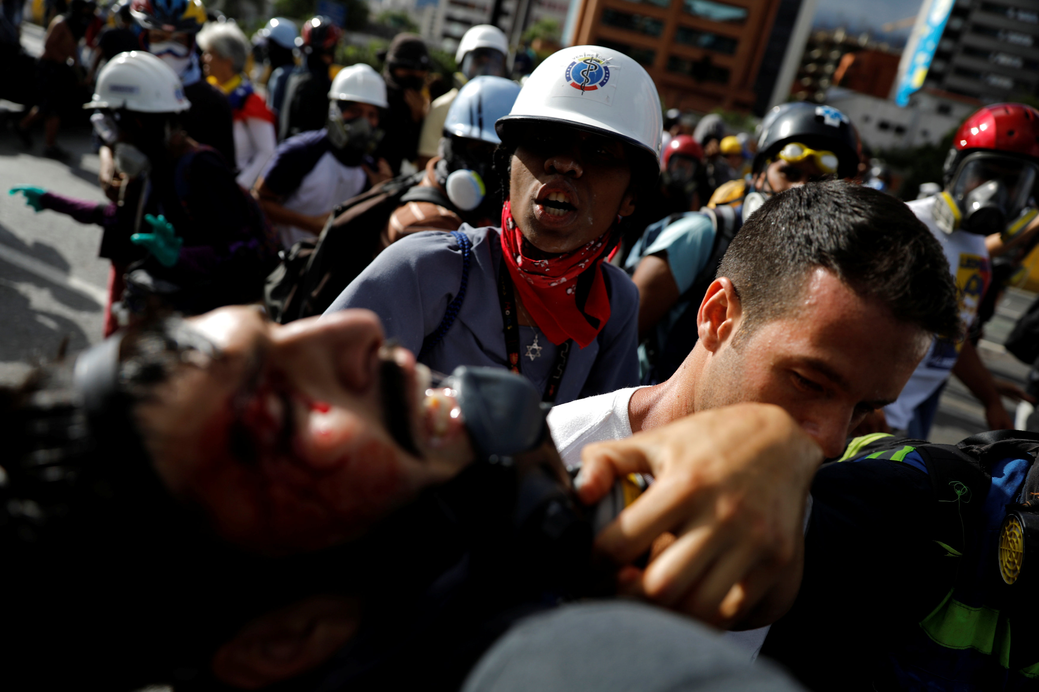 ATTENTION EDITORS - VISUALS COVERAGE OF SCENES OF DEATH OR INJURY A person reacts as an injured demonstrator is helped by others during a rally against Venezuela's President Nicolas Maduro in Caracas, Venezuela, June 10, 2017. REUTERS/Carlos Garcia Rawlins