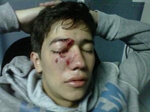 Así golpearon a un estudiante ayer en Táchira (FOTO)
