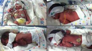 Dio a luz a dos pares de gemelos idénticos en el mismo parto