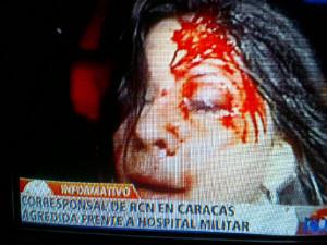 Corresponsal de RCN violentamente agredida frente al Hospital Militar (Fotos + Video)
