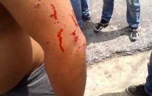 Abusos de la GNB: Militares atacan vivienda en Carabobo