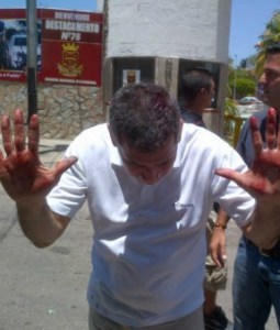 Motorizados golpean a diputados de Nueva Esparta (Foto + video)