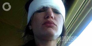 Melisa Rauseo sufre accidente durante su luna de miel (Foto)