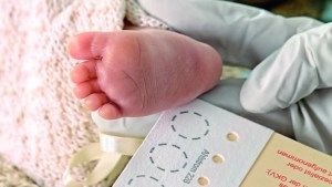 Células Madre trae Test Neonatal Suplementario a Venezuela
