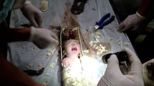 La madre de bebé que cayó en la letrina había ocultado su embarazo