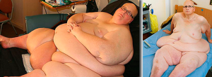 El ex hombre más obeso del mundo rebajó 300 kilos