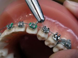 Detenidos por ofrecer servicios de ortodoncia sin permiso sanitario en Zulia
