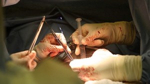 Cada hora mutilan a tres personas para obtener órganos para trasplantes