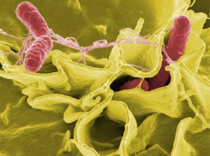La resistencia bacteriana: un enemigo silencioso de la salud pública