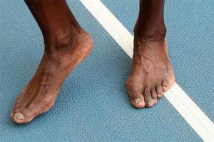 Así lucen los pies de Usain Bolt (Foto)