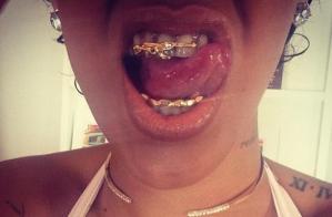 ¿Los brackets de Rihanna serán de oro? (Foto)