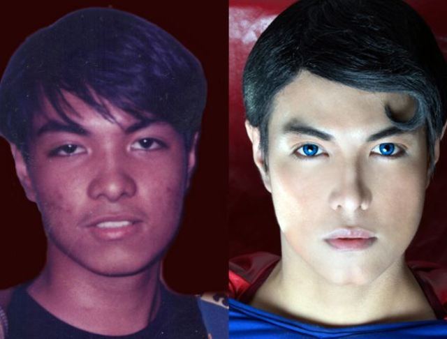 Se operó la cara 19 veces para parecerse a…¡Superman! (Fotos)