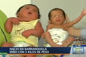 Nace “bebé gigante” en Colombia