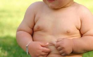La reducción de estómago a niños puede solucionar la obesidad infantil