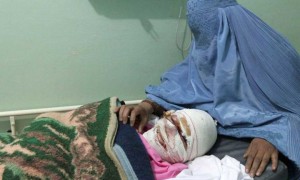 Hombre afgano corta los labios y la nariz a su esposa tras pelea conyugal