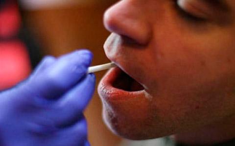 Brasil ofrecerá test rápido para diagnosticar sida con saliva