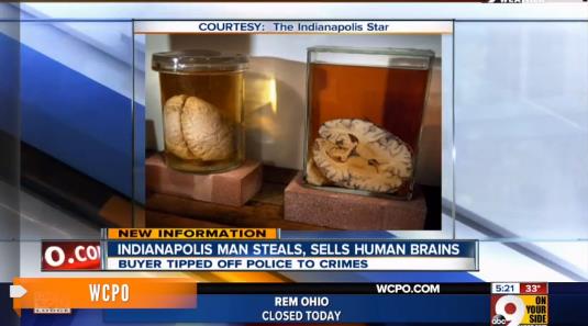 Detenido por robar restos de cerebro y venderlos en Internet