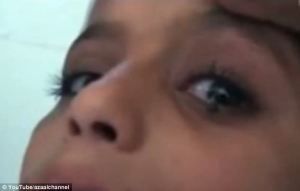 La niña de 12 años que llora piedras en vez de lágrimas (Video)