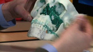 Impresora 3D mejora cirugías reconstructivas (Video)