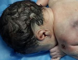 Abaleado en el vientre materno: No había nacido y la violencia venezolana lo tocó