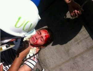 Herida periodista de El Nacional en concentración estudiantil (Foto)
