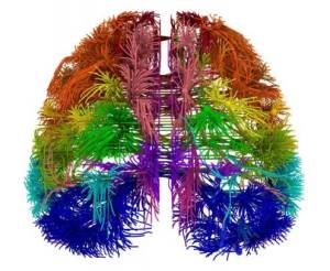 Científicos de EEUU presentan “un mapa” con las conexiones del cerebro humano