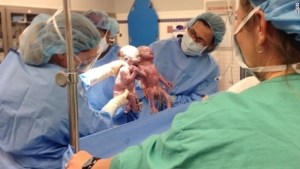 Una hermosa sorpresa de Día de la Madre: gemelas nacen tomadas de la mano