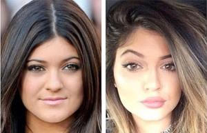 La hermana adolescente de Kim Kardashian ya usa botox (Fotos)