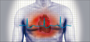 Ahora sí es posible reducir el riesgo de muerte luego de un Infarto