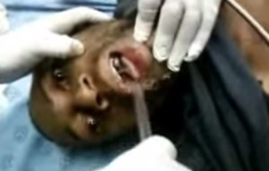 Fue al doctor porque tenía su teléfono atorado… en su garganta (Video)