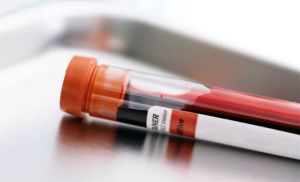 Análisis de sangre podría detectar el riesgo de suicidio