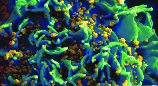 imagen-tridimensional-de-una-célula-infectada-de-VIH