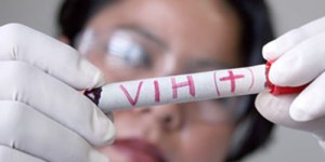 Los antirretrovirales reducen la trasmisión del VIH, según estudio