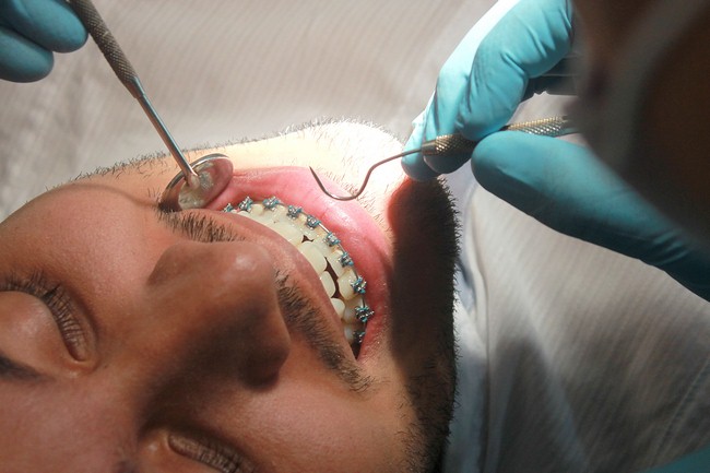 Odontólogos pasan las de Caín para conseguir insumos de trabajo