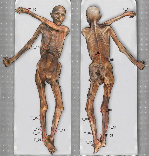 Foto: Localización de los tatuajes en el cuerpo de Ötzi, el Hombre de Hielo /  nationalgeographic.com.es
