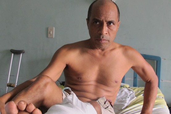 Francisco Vera esperó meses para recibir una operación para reparar su pierna fracturada. Más tarde, cuando le dio una infección, le amputaron la pierna en el Hospital Universitario de Caracas (Juan Forero/The Wall Street Journal)
