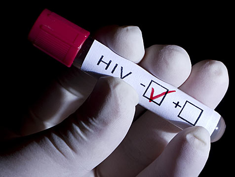 Investigadores japoneses descubren una proteína en humanos inhibidora del VIH