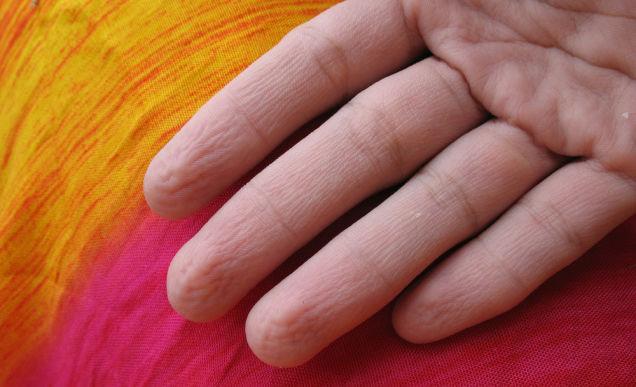 ¿Por qué se arrugan los dedos cuando los mojamos mucho tiempo?