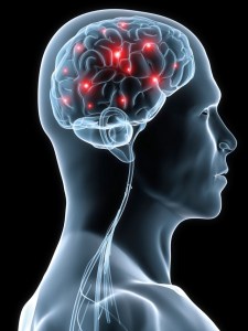 Esclerosis múltiple interrumpe la comunicación entre las neuronas