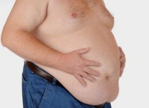 Vínculos entre la obesidad y la Psoriasis