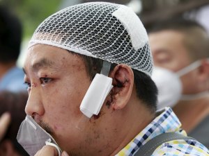 Ciudadanos de Tianjin se quejan de ardor en la piel tras primeras lluvias