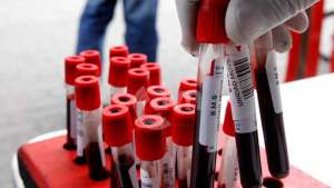 Ministerio de Salud no enviará más reactivos a bancos de sangre