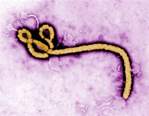 En esta imagen de archivo sin fecha y a color, puesta a disposición por el CDC, se muestra una partícula de un virus de ébola. El virus puede permanecer hasta nueves meses en los varones sobrevivientes de ébola, informó un estudio publicado el miércoles 14 de octubre de 2015 en la revista New England Journal of Medicine. (Frederick Murphy/CDC via AP, File)
