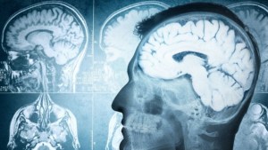 Científicos reactivan recuerdos a través de estimulación magnética