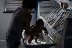 Médicos calculan que 1.400 niños nacerán con microcefalia en Venezuela
