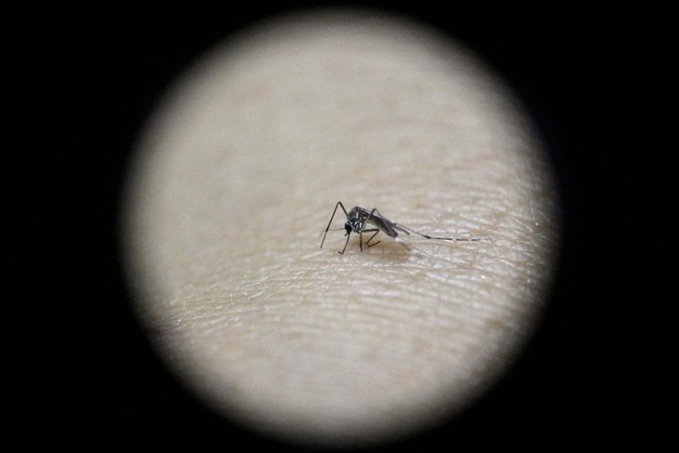 Aumentan casos de bebés con microcefalia en Brasil en medio de epidemia de zika