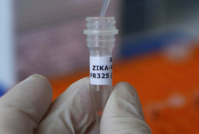 An employee examines a tube with the label 'Zika virus' at Genekam Biotechnology AG in Duisburg, Germany, February 2, 2016. Genekam Biotechnology AG has developed the ready to use PCR kit (Polymerase Chain Reaction kit) to detect the Zika virus in mosquitoes and samples of human beings. REUTERS/Ina Fassbender