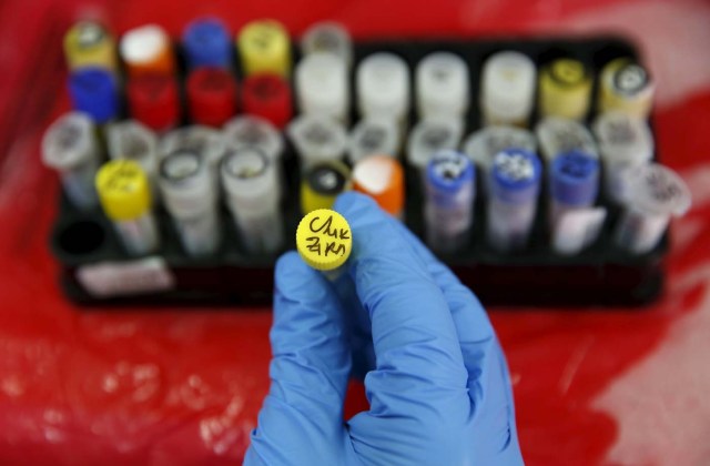 A health technician shows a blood sample from a patient bitten by a mosquito at the National Institute of Health in Lima, Peru, February 2, 2016. The laboratory screens blood samples for the Zika virus and other mosquito-borne diseases. REUTERS/Mariana Bazo