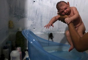 Identificada la relación del virus del Zika y la microcefalia en fetos y bebés